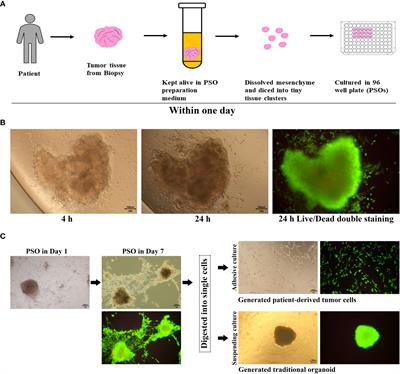 BME-free primary patient-specific organoids obtained with a one-day mimicking method to replicate the corresponding tumor for personalized treatment options
